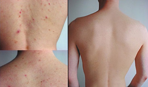 Xà phòng trị mụn Some By Me còn giúp loại bỏ mụn thâm, nứt nẻ da, tẩy trang dễ dàng Xà phòng trị mụn Some By Me còn giúp loại bỏ mụn thâm, nứt nẻ da, tẩy trang dễ dàng