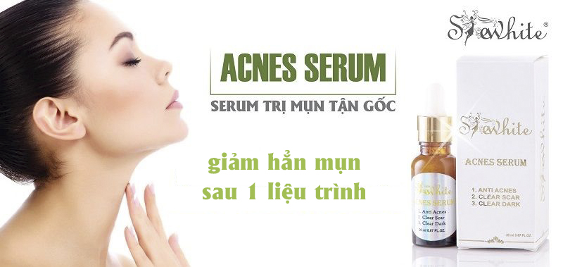 Serum Shewhite điều trị mụn hiệu quả, nhanh chóng