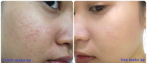 Kem nền NEUTROGENA Skin Clearing Oil  che lấp mọi khuyết điểm do mụn, sẹo, vết nhăn, vết thâm
