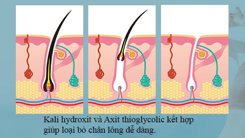 Loại bỏ nang chân lông dễ dàng hơn với Veet nhờ công thức đặc biệt