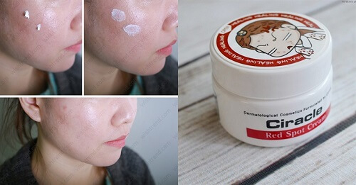 Kem trị mụn Ciracle Red Spot Cream giúp loại bỏ mụn nhanh chóng, dễ dàng