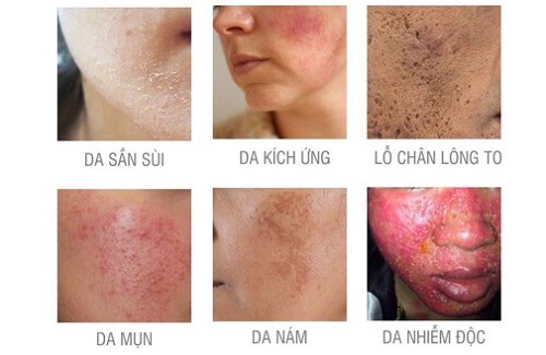 Tẩy tế bào chết chính là bước đệm quan trọng để quá trình chăm sóc da được tốt hơn
