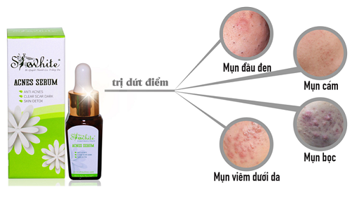 Serum trị mụn Shewhite với 3 tác động trị mụn - xóa thâm- dưỡng da