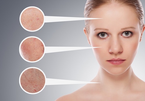 Sử dụng thuốc trị mụn loại bỏ các đốm mụn cho da mềm mịn