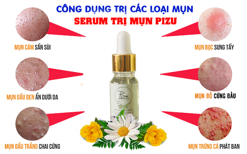 Serum trị mụn Pizu là một trong những loại thuốc trị mụn tốt nhất hiện nay