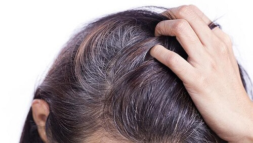 Mái tóc bạc sớm khiến bạn lo lắng và mất tự tin???