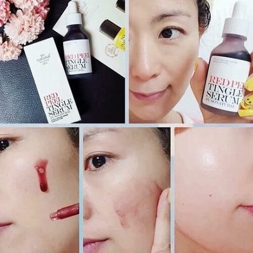 Tinh chất serum The Ordinary giúp da trắng hồng, rạng rỡ hơn mỗi ngày Tinh chất serum The Ordinary giúp da trắng hồng, rạng rỡ hơn mỗi ngày