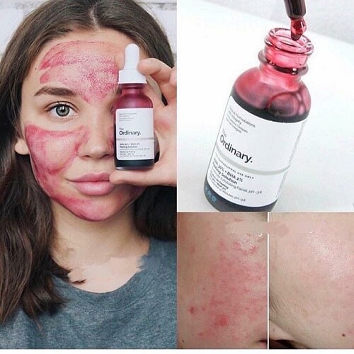 Tinh chất serum The Ordinary cho da mềm mịn, bật tông hiệu quả Tinh chất serum The Ordinary cho da mềm mịn, bật tông hiệu quả