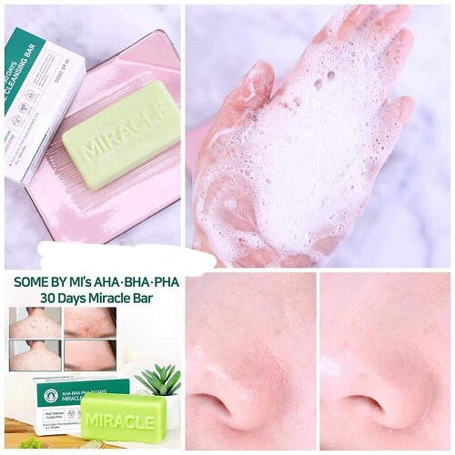 Sử dụng xà phòng trị mụn Some By Me mỗi ngày để đem lại hiệu quả nhanh hơn Sử dụng xà phòng trị mụn Some By Me mỗi ngày để đem lại hiệu quả nhanh hơn