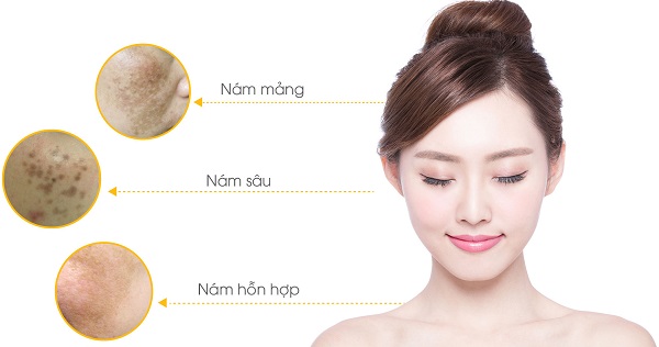 Sạm, nám cũng dễ dàng bị loại bỏ nhờ các dưỡng chất có trong mặt nạ Collagen Luxury Gold 
