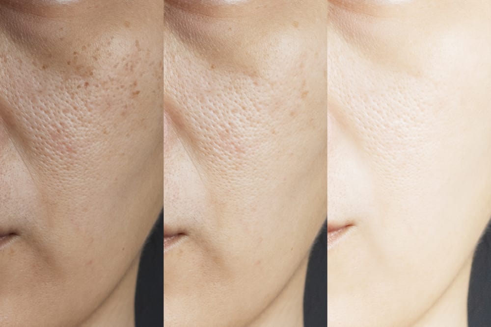 Toner Some By Mi AHA-BHA-PHA 30 Days Miracle giúp cho lỗ chân lông trên da thu nhỏ lại