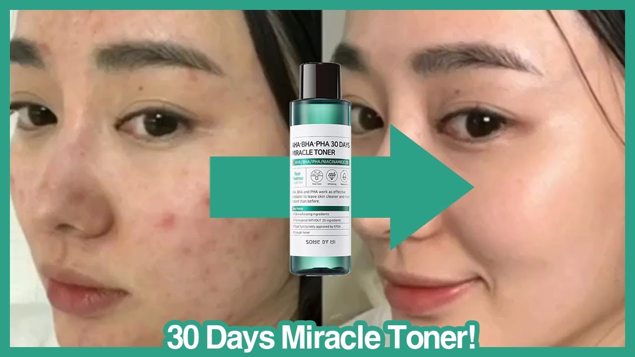 Some By Mi AHA-BHA-PHA 30 Days Miracle giúp da chống lại những tác hại xấu gây ra mụn