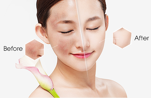 Bạn sẽ dễ dàng sở hữu làn da hoàn hảo nhờ kem dưỡng trắng da White Conc