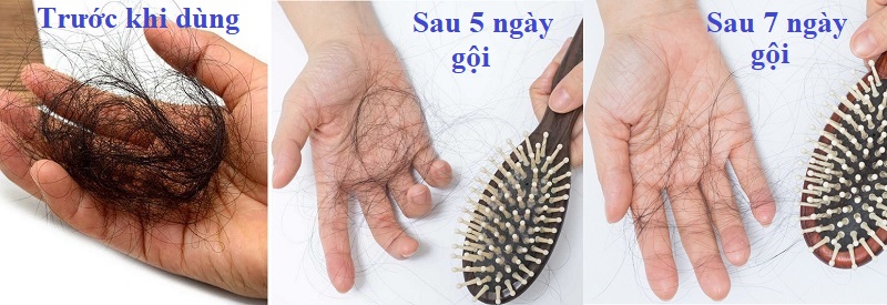 Bộ dầu gội Tigi Bed Head chính là sự lựa chọn hoàn hảo giúp bạn chăm sóc mái tóc đơn giản, hiệu quả